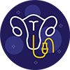Hysteroscopy